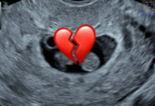 A Second Heartbreak: My Miscarriage 10 Months Postpartum